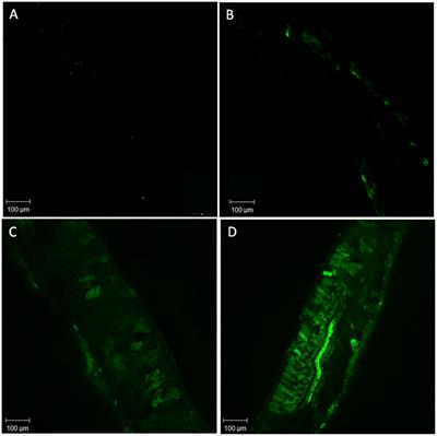 The Involvement of Nitric Oxide in Integration of Plant Physiological and Ultrastructural Adjustments in Response to Arsenic